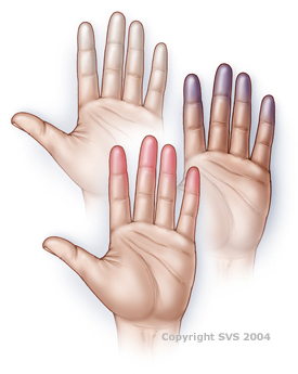 vascular hands